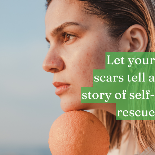 Let your scars tell a story of self-rescue, not self-pity.